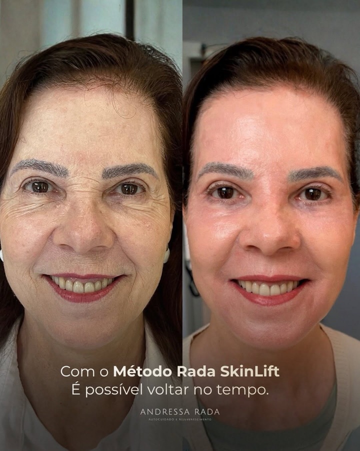 Post recente da Dra. Andressa Rada no Instagram